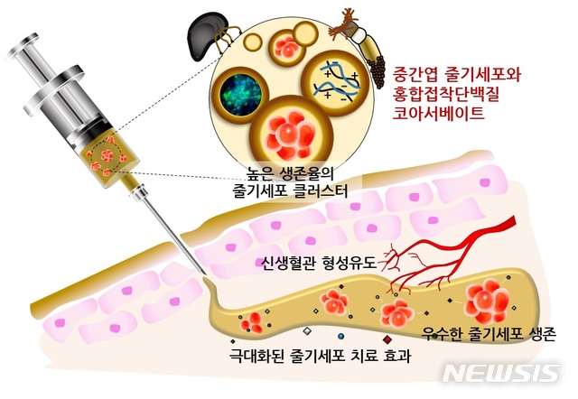 【포항=뉴시스】강진구 기자 = 포스텍(총장 김도연)은 화학공학과 차형준 교수팀이 홍합의 접착물질을 이용해 체내 표적 부위에 주사를 통해 쉽게 줄기세포를 전달하고 유지할 수 있는 액상의 접착성 전달체를 개발했다고 25일 밝혔다.사진은 홍합 접착물질 이용 줄기세포 전달체 관련 연구도.2019.01.25.(사진=포스텍 제공) photo@newsis.com