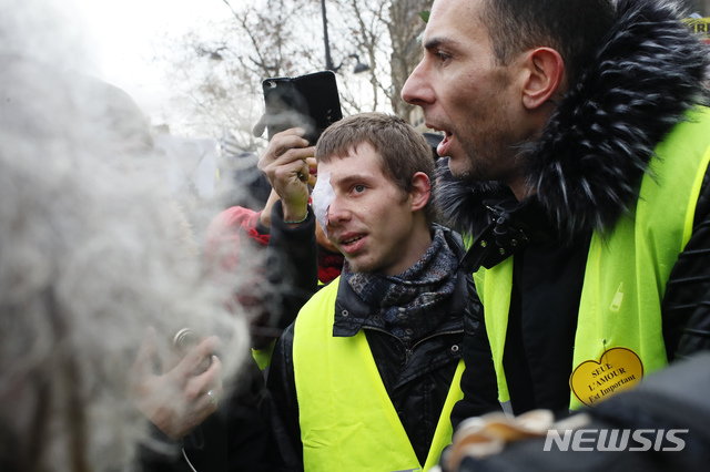 【파리=AP/뉴시스】2일(현지시간) 프랑스 파리에서 노란 조끼 집회가 열린 가운데 경찰의 고무탄 발사로 부상한 사람들이 집회에 참여하고 있다. 12주 연속 토요 집회를 벌이고 있는 이들은 그동안 경찰과의 충돌 중 부상한 동료들에게 유감과 경의를 표할 계획이다.작년 11월 중순 시작해 매주 토요일 전국에서 열린 '노란 조끼' 연속집회 중 경찰이 쏜 고무탄에 실명하거나 머리를 맞아 중상을 입는 등 부상자가 발생해 인권 단체 등에서 이의 사용 중단을 요구했으나 프랑스 법원은 이를 기각했다. 2019.02.02. 