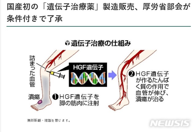 【서울=뉴시스】일본 정부가 다리 혈관이 막히는 중증 허혈성 질환을 치료하는 유전자 치료약 '콜라테젠'의 국내 제조·판매를 조건부 승인했다. 콜라테젠은 새로운 혈관을 만들어내는 단백질(HGF)을 생성하는 유전자를 환부 근육에 주사하는 방식으로 치료한다.(사진출처:요미우리신문 홈페이지 캡쳐)2019.02.21.