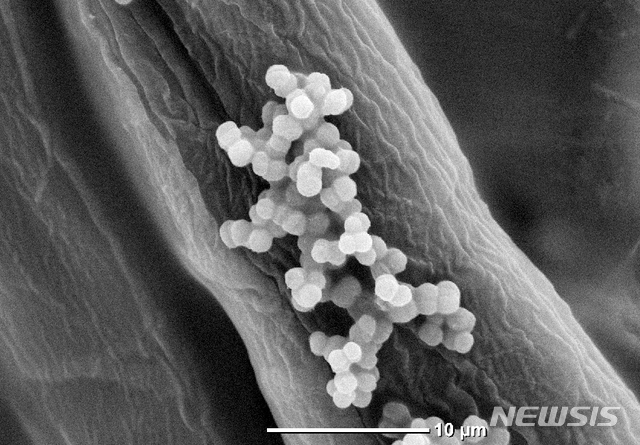 장내 미생물이 건강의 열쇠…마이크로바이옴이 뜬다
