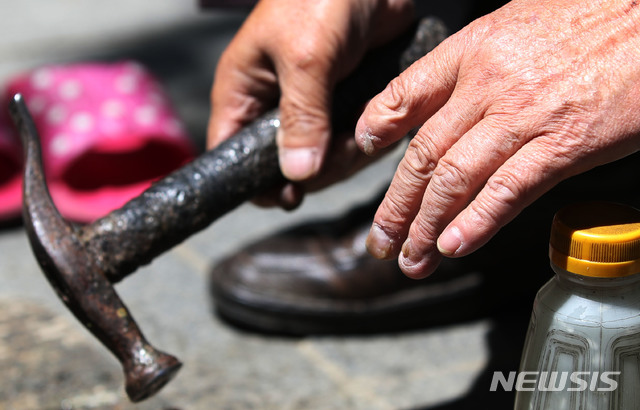 엄지손가락 잃은 구두 수선공, '발가락' 이식해 일터로 복귀