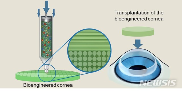 【포항=뉴시스】강진구 기자 = 포스텍(총장 김도연)은 기계공학과 조동우 교수와 창의IT융합공학과 장진아 교수팀이 경북대 의대 안과 김홍균 교수팀과 공동연구를 통해 탈세포화된 각막 조직과 줄기세포를 섞어 만든 바이오잉크를 사용해 3D 프린팅 기술로 인공 각막을 제작하는 데 성공했다고 14일 밝혔다.사진은 관련 연구흐름도.2019.05.14.(사진=포스텍 제공)  photo@newsis.com