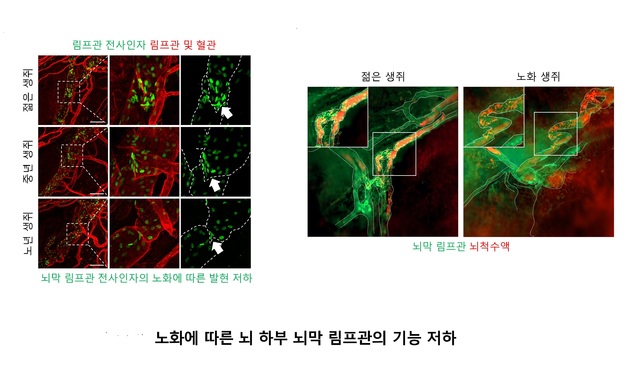 고규영 연구팀, 치매 등 유발 뇌 노폐물 배출 경로 세계 최초 규명