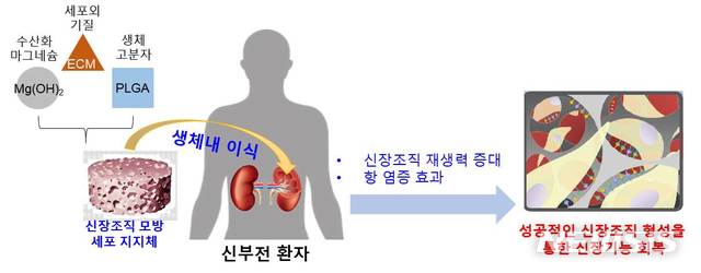 【서울=뉴시스】생체모방과 나노기술를 이용한 신장조직 재생용 지지체. 이 연구에서는 실제 신장조직 구조를 모방한 지지체를 개발함으로써 손상된 신장의 재생을 촉진시키는 전략을 수립했다. 다양한 성장인자가 포함되어 있고 신장조직과 유사한 특성을 가진 세포외기질(ECM)를 첨가하였다. 또한 pH 중화 효과가 있는 수산화마그네슘(Mg(OH)2)도 첨가하였다. 세포외기질은 손상된 신장조직에서 세포 성장 및 분화를 유도할 수 있고, 수산화마그네슘은 낮은 pH로 산성화된 신장조직 내 환경을 pH중화시켜 염증반응을 현저히 억제할 수 있었다.(그림/한동근 교수·박우람 교수(차의과학대학교) 연구팀 제공)  photo@newsis.com