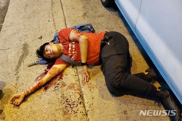 【서울=뉴시스】16일 괴한들로부터 망치 공격을 받아 유혈이 낭자한 모습으로 쓰러져 있는 홍콩 반정부시위 주최 단체 홍콩 민간인권전선(CHRF)의 주요 지도자 지미 샴의 모습. CHRF는 이번 공격이 정치적 이유에서 비롯된 테러라고 비난했다. <사진 출처 : CHRF 페이스북> 2019.10.16