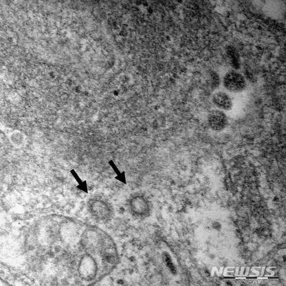 [세종=뉴시스]임재희 기자 = 신종 코로나바이러스(SARS-CoV-2) 입자를 전자 현미경으로 확대한 모습. 질병관리본부는 10일 코로나19 항체 탐지용 단백질을 개발했다고 밝혔지만 실제 치료제 개발까지는 최소 3개월은 더 필요하다.(사진=질병관리본부 제공) 2020.02.27. photo@newsis.com 