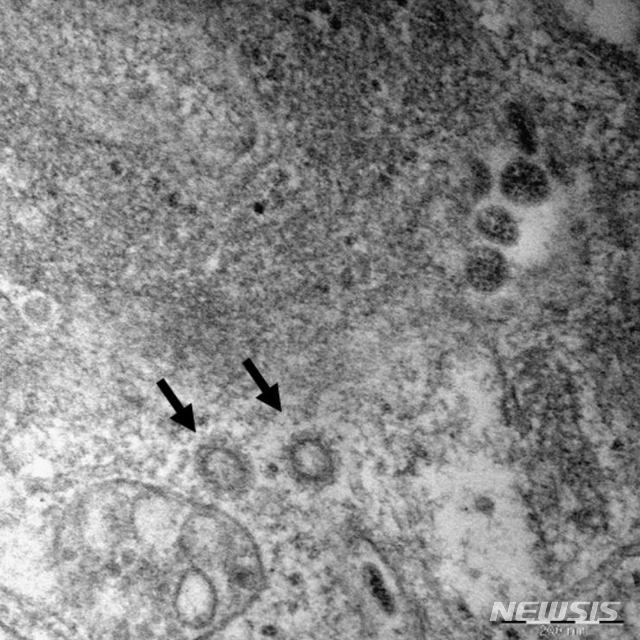 [서울=뉴시스]김근현 기자 = 질병관리본부는 6명의 신종 코로나바이러스 감염증(코로나19) 환자로부터 얻은 코로나19 바이러스(SARS-CoV-2)의 고해상 전자현미경 사진을 공개했다. (사진=질병관리본부 제공) 2020.02.27.photo@newsis.com