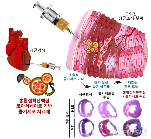 [포항=뉴시스] 강진구 기자 = 포스텍(총장 김무환)은 화학공학과 차형준 교수, 박사과정 박태윤씨 팀이 여의도성모병원 흉부외과 심성보 교수, 대전성모병원 흉부외과 이종호 교수팀과 함께 홍합이 가진 강력하면서도 인체에 무해한 단백질과 줄기세포를 이용해 효과적인 심근경색용 줄기세포 치료제를 개발했다고 23일 밝혔다.사진은 심근경색 줄기세포치료제 모식도.(사진=포스텍 제공) 2020.03.23. photo@newsis.com