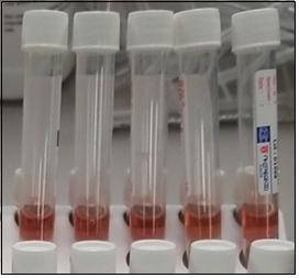[서울=뉴시스] 회수 대상 제품(사진=식품의약품안전처 제공)