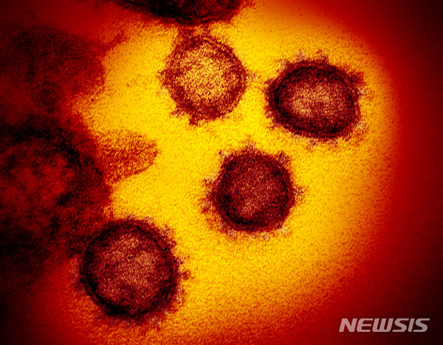[AP/뉴시스] 미국에서 EG.5 변이가 코로나19 우세종이 됐다고 미 질병통제예방센터(CDC)가 추산했다고 CBS뉴스가 7일(현지시간) 보도했다. 사진은 미 국립보건원(NIH)이 전자현미경으로 관찰한 코로나19 바이러스의 모습. 2023.08.08.