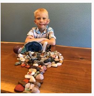 [서울=뉴시스] 맹견의 공격으로부터 여동생을 구해낸 미국의 6세 소년 브리지 워커의 모습. 뺨에 큰 부상을 입어 2시간에 걸쳐 90바늘이나 꿰매야했다고 16일(현지시간) CNN은 전했다. <사진출처:브리지 워커 인스타그램> 2020.07.16