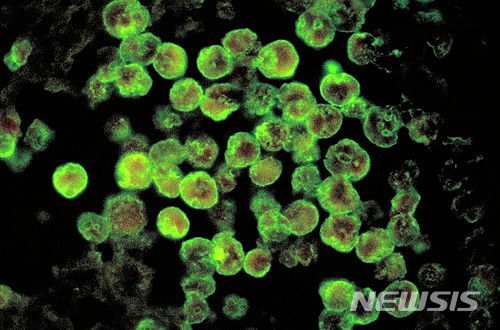 [서울=뉴시스] 뇌 먹는 아메바인 '네글레리아 파울러리' 아메바의 현미경 사진. (사진출처: 위키피디아) 2020.09.27