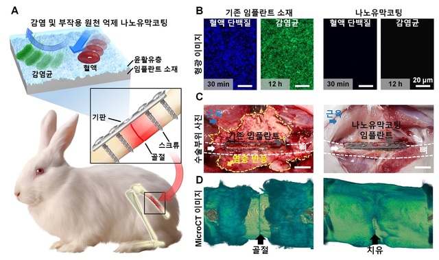 국내 연구진, 임플란트 표면 감염균 부착 막아줄 코팅 기술 개발