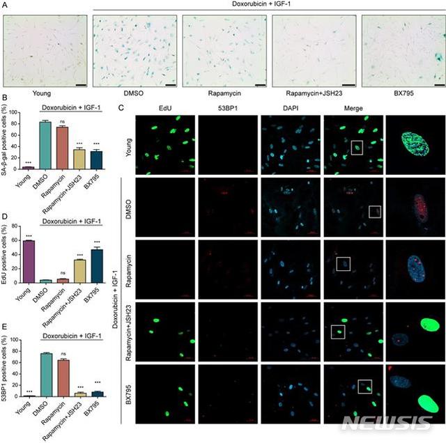 [대전=뉴시스] 세포노화의 역행에 대한 표현형 검증. 노화된 세포에 PDK1 단백질 저해제(BX795)를 첨가하거나 mTOR와 NF-kB 저해제(Rapamycin과 JSH23)를 동시에 첨가했을 때 세포노화 표지 인자인 SA-β-Gal(senescence-associated beta-galactosidase)가 감소(그림 A~B)하고 세포 증식 마커인 EdU가 증가(C~D)하며 DNA 손상 반응 마커인 53BP1이 감소(C~E)하는 것을 확인할 수 있다.
