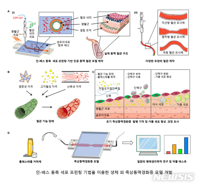 [포항=뉴시스] 강진구 기자 = 포스텍(총장 김무환)은 기계공학과 조동우 교수, 창의IT융합공학과 장진아 교수, 가오그(高戈) 박사, 통합과정 박원빈씨, 김병수 박사 공동연구팀이 생체 밖에서 죽상동맥경화증을 관찰할 수 있는 인공동맥혈관 모델을 만들었다고 18일 밝혔다.사진은 인공동맥혈관 모델 프린팅.(사진=포스텍 제공) 2021.01.18.photo@newsis.com