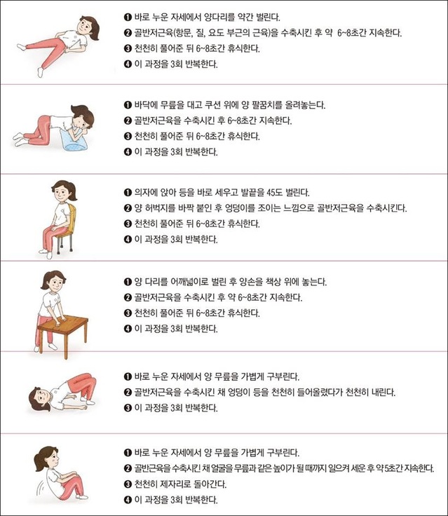 골반저근운동법. (그림=서울백병원 제공) *재판매 및 DB 금지