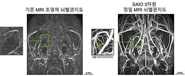 [대전=뉴시스] SAIO 뇌혈관 지도. SAIO를 활용해 쥐의 뇌를 MRI로 촬영한 모습으로 머리카락 굵기(100㎛)의 미세혈관까지 선명히 볼 수 있는 3차원 정밀 MRI 뇌혈관 지도를 구현할 수 있다. *재판매 및 DB 금지