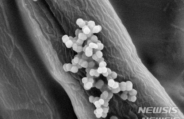 [서울=뉴시스]﻿﻿신경발달장애인 자폐스펙트럼장애(ASD) 아동과 정상 아동 간 분변 내 장내 마이크로바이옴(미생물)의 분포와 기능에 차이가 있다는 연구 결과가 나왔다. (사진= 뉴시스DB) 2021.04.22