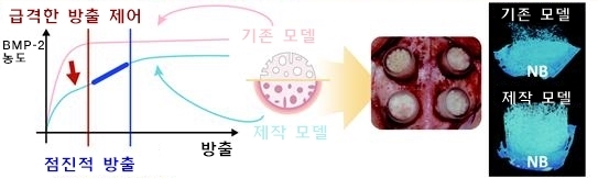 연세대 치과대학 치주과학교실 차재국·정의원 교수, 연세대 화공생명공학과 홍진기 교수 연구팀은 임플란트 식립 시 합병증을 크게 줄이면서 치조골 재생 능력을 높일 수 있는 방법을 규명했다고 6일 밝혔다.(사진 : 세브란스병원 제공) *재판매 및 DB 금지