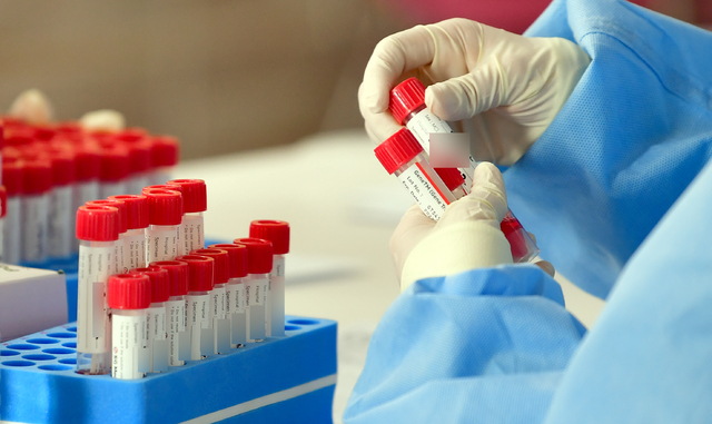 [광주=뉴시스] = 코로나19 검사 키트. (사진=뉴시스 DB). photo@newsis.com 