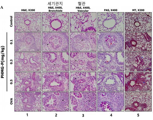 [대전=뉴시스]PHMG-p의 기도 내 투여에 의한 폐 조직 병리 사진. 대조군과 PHMG-p 0.1㎎/㎏, 0.3㎎/㎏, 0.5㎎/㎏를 각각 투여한 그룹, OVA(난백알부민을 투입한 천식 유도군)군의 폐의 조직을 염색한 사진으로 폐의 염증 소견을 확인할 수 있다. *재판매 및 DB 금지