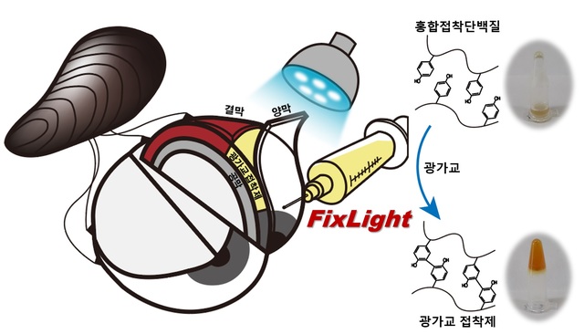 광가교 홍합단백질 접착제를 사용한 비봉합 양막 이식  *재판매 및 DB 금지