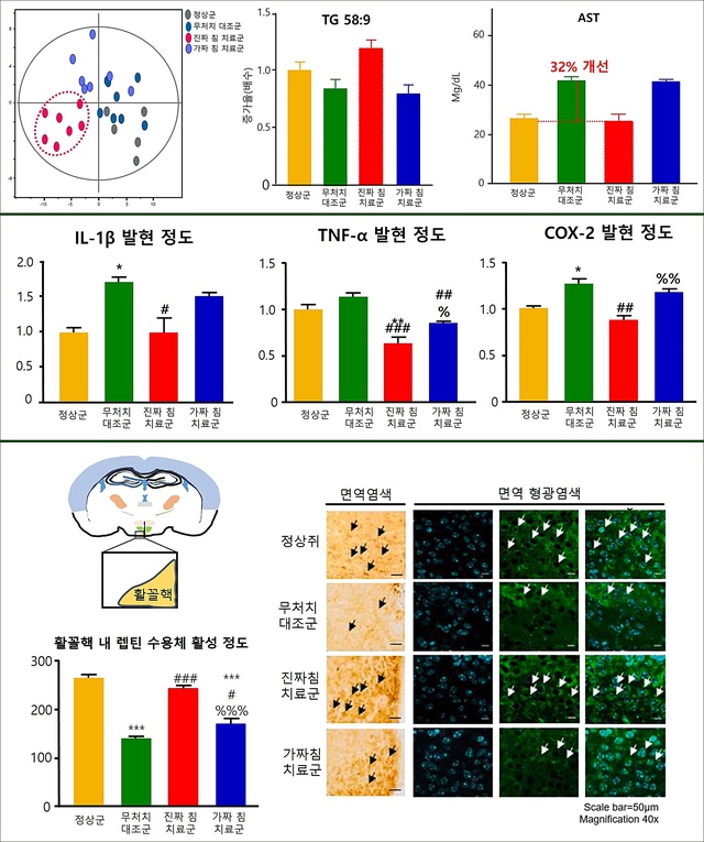 [대전=뉴시스] 간정격 침 치료에 따른 우울증 동물모델에서의 지질대사 이상 개선(위)과 간정격 침 치료의 우울증 관련 염증 인자 발현 억제 정도(가운데). 아래는 침 치료 후 우울증 동물모델에서 렙틴 수용체 활성 개선을 나타낸다. *재판매 및 DB 금지