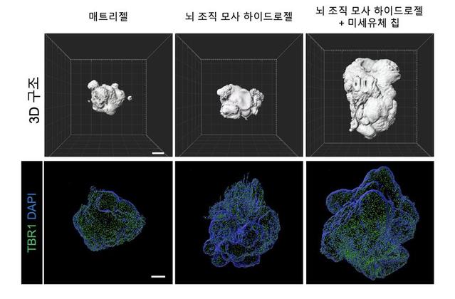 [대전=뉴시스] 기존 뇌 오가노이드와 연구진이 제작한 뇌 오가노이드의 3차원 이미지 비교 그림. 기존 뇌 오가노이드에 비해 연구진이 제작한 뇌 오가노이드는 더 발달된 구조와 크기를 보이고 피질 단백질(TBR1)도 더 많이 발현됐다. *재판매 및 DB 금지