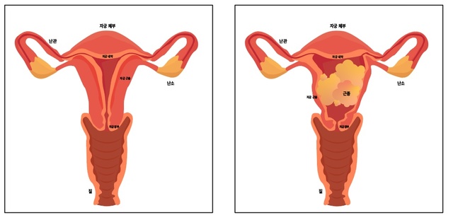 [부산=뉴시스] (자료=온종합병원 제공) *재판매 및 DB 금지