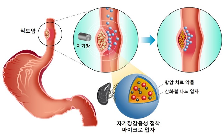 [포항=뉴시스] 강진구 기자 = 포스텍(총장 김무환)은 화학공학과 차형준 교수, 석박사 통합과정 최현선 씨 연구팀이 경북대학교 의생명융합공학과 조윤기 교수와의 공동연구를 통해 홍합접착단백질에 자기장 감응성을 부여한 접착성 마이크로입자를 개발했다고 29일 밝혔다.사진은 연구모식도.(사진=포스텍 제공) 2021.09.29.photo@newsis.com *재판매 및 DB 금지