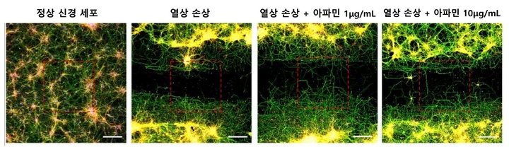 고배율 현미경 관찰 상 열상 손상을 가한 신경세포와 비교해 아파민을 처리한 신경세포에서는 아파민 농도가 높을수록 축삭돌기의 재생량과 길이가 증가했다. (사진=자생한방병원 제공) *재판매 및 DB 금지