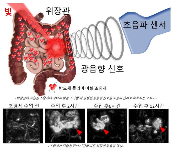 [포항=뉴시스] 강진구 기자 = 포스텍(총장 김무환)은 IT융합공학과·전자전기공학과·기계공학과 김철홍 교수·박별리 박사 연구팀이 중국 톈진대학교 유미아오 장(Yumiao Zhang) 교수·박사과정 위안멍 딩(Yuanmeng Ding) 씨 연구팀과의 공동 연구를 통해 생체의 심부 조직을 고통없이 볼 수 있는 광음향 영상법을 개발했다고 8일 밝혔다.사진은 연구 관련 그림.(사진=포스텍 제공) 2021.12.08.photo@newsis.com *재판매 및 DB 금지