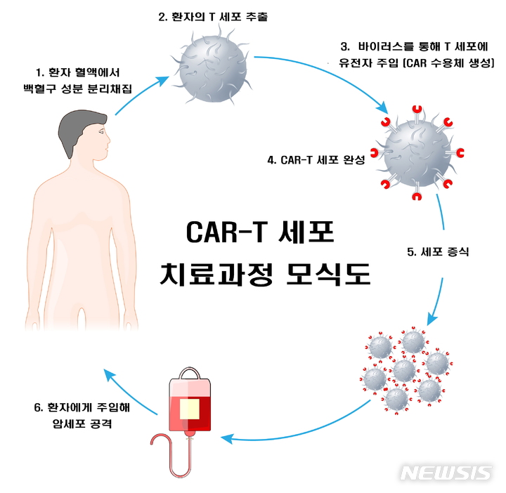 [서울=뉴시스]CAR-T 치료란 환자 혈액에서 얻은 면역세포(T세포)가 암을 잘 인식할 수 있도록 유전자 조작을 거친 뒤, 배양해 다시 환자의 몸속에 집어넣는 치료법이다. 면역세포가 암세포만을 찾아 정확히 표적하면서도 체내 정상세포 손상을 최소화해 획기적인 최신 치료법으로 주목받고 있다. (이미지= 서울대병원 제공) 2021.12.09