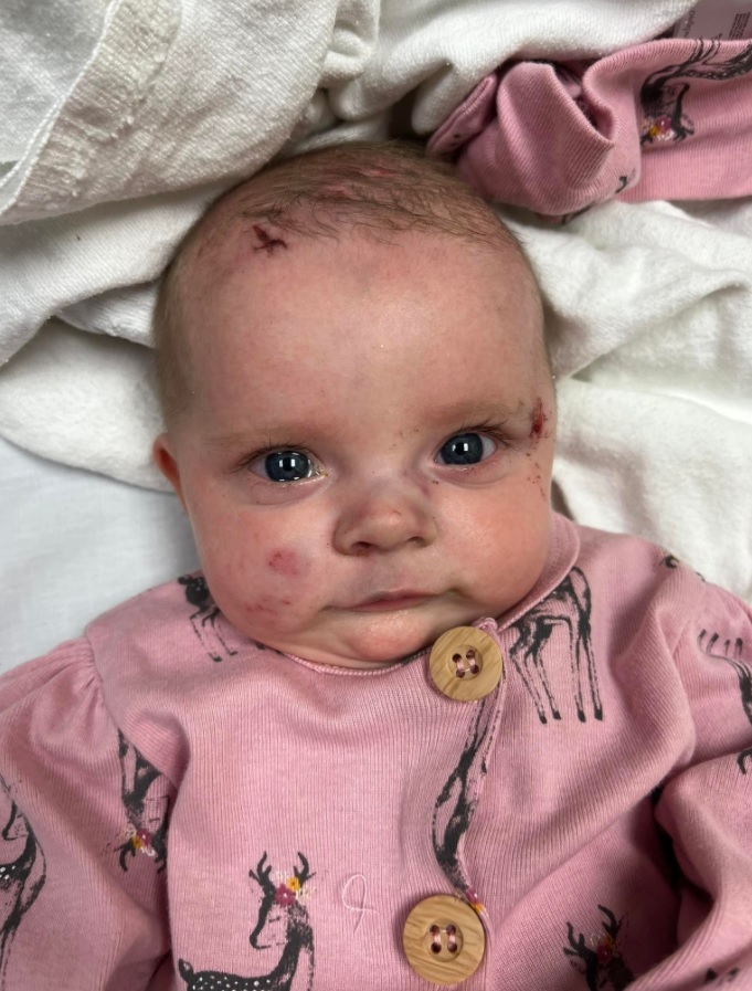 [서울=뉴시스] 지난 10일 미국 켄터키에서 발생한 토네이도로 병원에 입원해있던 생후 2개월 오클린 쿤이 13일(현지시간) 사망했다. 쿤은 현재까지 밝혀진 사망자 중 가장 어린 희생자로 밝혀져 안타까움을 사고 있다. (출처 : 오클린 아버지 '더글러스' 페이스북 홈페이지 사진) 2021.12.14. *재판매 및 DB 금지