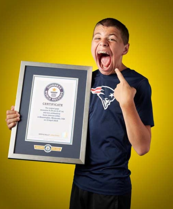 [서울=뉴시스] 미국 미네소타주 아이작 존슨(16)이 지난 6월 세계에서 가장 입이 큰 소년에 올랐다. (출처 : 기네스북 공식 홈페이지) 2021.12.16. *재판매 및 DB 금지