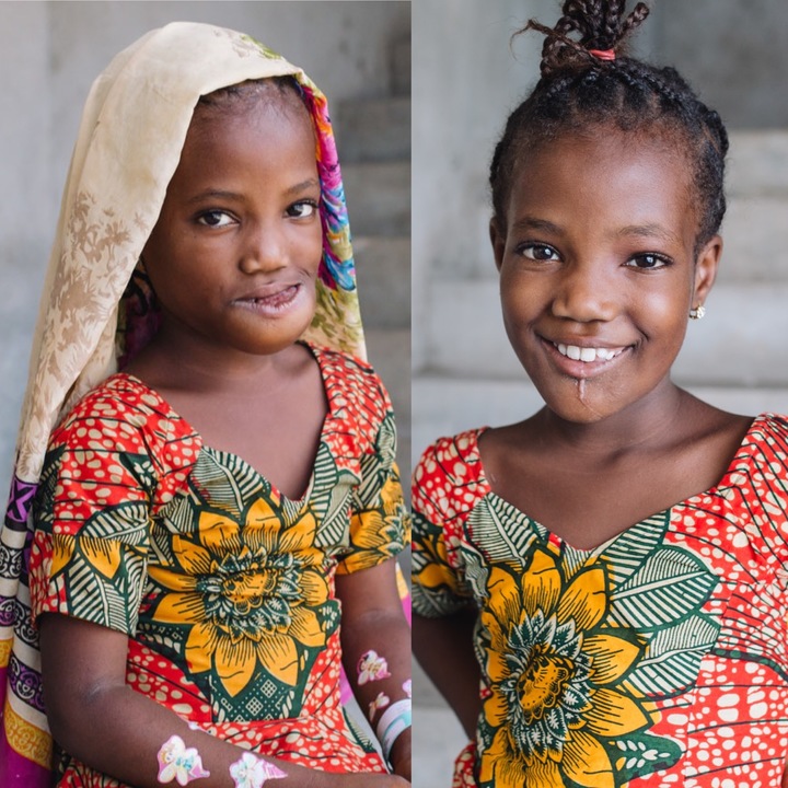 [서울=뉴시스] 아프리카 기니에서 태어날 때부터 하관에 종양을 갖고 태어난 10세 소녀가 세계 최대 비정부 자선단체 병원선 머시쉽스가 제공한 무상 수술을 받고 최근 일상을 되찾았다. 종양 제거 전(왼쪽)과 후(오른쪽) 모습이다. (출처 : 트위터 갈무리) 2022.01.12. *재판매 및 DB 금지