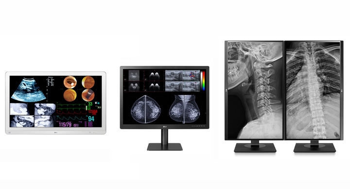 수술용 모니터(왼쪽부터), 진단용 모니터, 임상용 모니터. (사진=LG전자 제공) *재판매 및 DB 금지