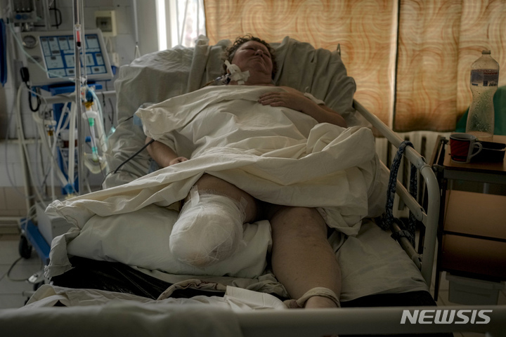 [키이우=AP/뉴시스] 러시아군의 통제를 받고 있는 마을에서 총상을 입은 여성이 다리를 절단 후 13일 우크라이나 키이우 북부 브로바리의 한 병원 중환자실에 누워있다. 2022.03.13. *재판매 및 DB 금지