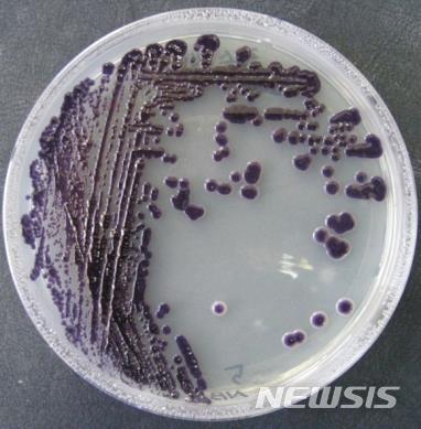 [서울=뉴시스] 마실리아 균주(Massilia sp. NB-5)/