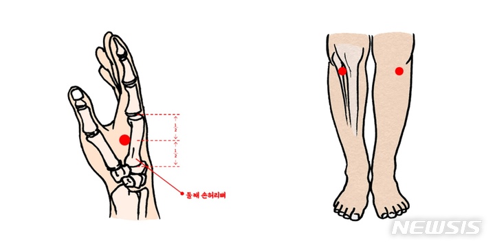 [서울=뉴시스]왼쪽부터 소화불량 개선에 효과적인 합곡혈과 족삼리혈.(사진= 자생한방병원 제공) 2022.03.21
