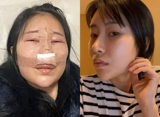 [서울=뉴시스] 이세영 2021.03.21.(사진=이세영 유튜브,SNS) photo@newsis.com *재판매 및 DB 금지