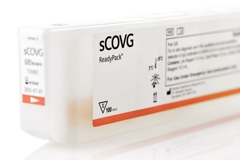 지멘스 헬시니어스의 SARS-CoV-2 IgG 항체검사(사진 : 지멘스 헬시니어스 제공) *재판매 및 DB 금지