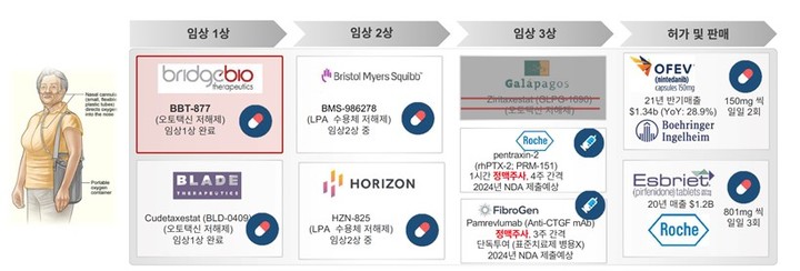 폐섬유증 치료제 개발 현황 (사진=브릿지바이오테라퓨틱스 제공) *재판매 및 DB 금지