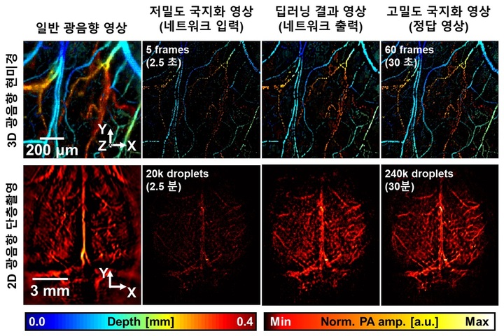 포스텍, 광음향기술로 고속·고해상도 혈관영상 찍는다