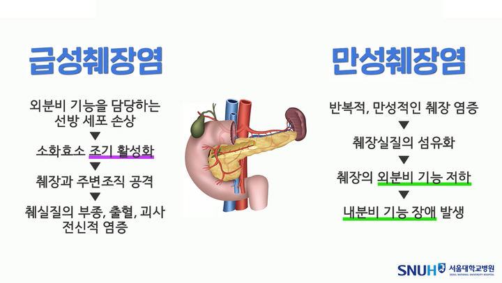 급성·만성 췌장염 비교(사진 : 서울대병원 제공) *재판매 및 DB 금지