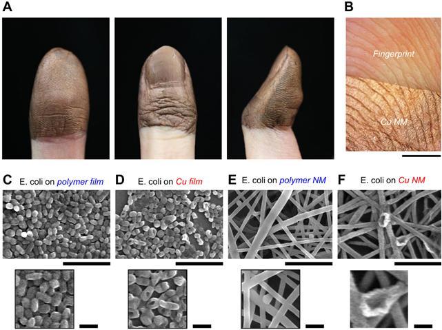 [대전=뉴시스] 피부에 일체화된 구리 나노메쉬 패치와 다양한 표면 위의 대장균 비교. A는 피부 일체화 구리 나노메쉬 패치고 B는 지문 위 부분코팅된 구리 나노메쉬 패치다. C와 D는 고분자 필름 위의 대장균과 구리 필름 위의 손상된 대장균이며 E와 F는 각 고분자 나노메쉬 패치 위 대장균, 구리 나노메쉬 패치 위의 사멸된 대장균의 모습이다. *재판매 및 DB 금지