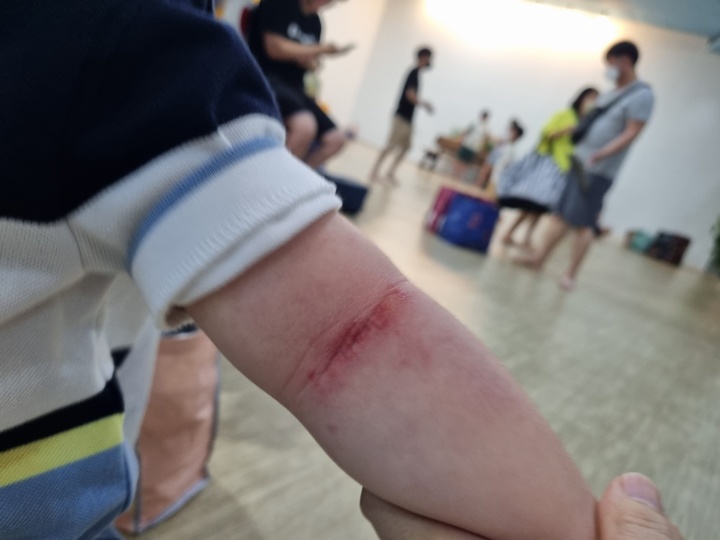 [대구=뉴시스]김정화 기자 = 대구의 한 워터파크에서 3세 남아의 팔이 빨려 들어가는 사고가 발생해 경찰이 조사에 나섰다. (사진 = 피해 아동 가족 제공) 2022.06.29. photo@newsis.com