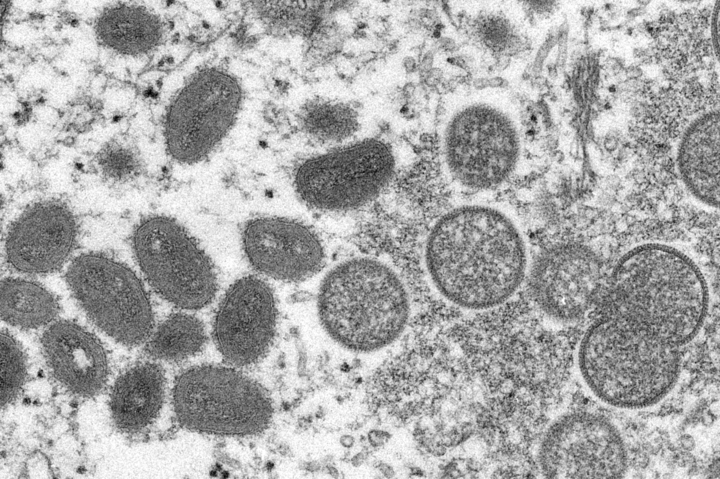 [AP/뉴시스]미국 질병통제예방센터가 공개한 원숭이두창 바이러스. 2022.07.25. *재판매 및 DB 금지