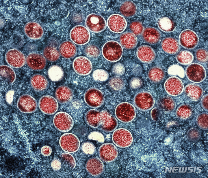 [AP/뉴시스] 미국 국립알레르기감염병연구소(NIAID)가 제공한 이미지로, 투과전자현미경으로 감염된 세포(파란색) 내 엠폭스 입자(빨간색)가 보이고 있다. 2023.04.13.