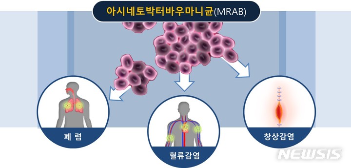 [서울=뉴시스] 아시네토박터 바우마니균 감염증.